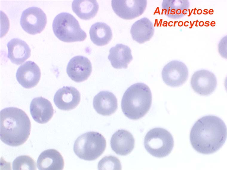 Cytologie Des An mies
