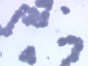 Rouleaux d'hématies