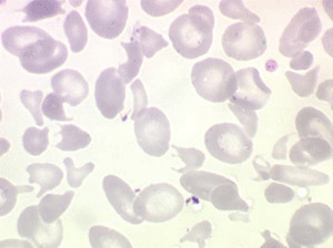 Mycrocytose