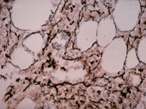 Trame réticulinique